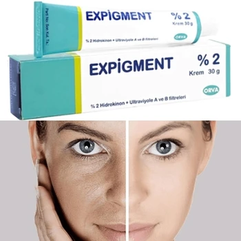 Expigment 30 g 1oz Hidrokinona Smetane 2% Za Beljenje Kože za Posvetlitev Kože, Beljenje Kože, Melasma Anti-blemish