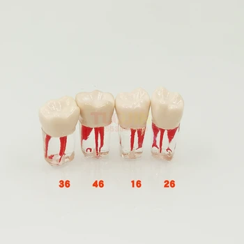 2pcs Zobozdravstveno Usposabljanje Izdelka Zobna Root Canal Zob Za Študente Praksi Model Študija Poučevati Predstavitev Orodja